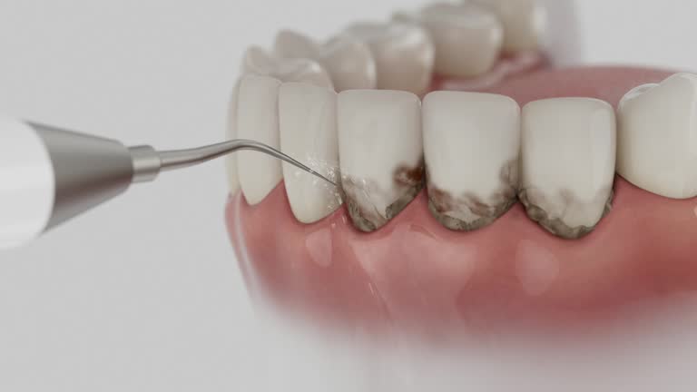 Reliable Dental Implants contractor in Wellford, SC by Smile Center Dentistry